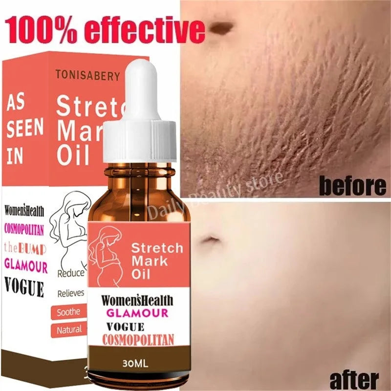 "SOIN" Huile essentielle, grossesse pour corps, nouveau  sérum d'élimination des vergetures, augmente l'élasticité de la peau
